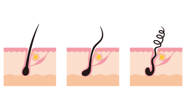 直毛とくせ毛の毛根の違い