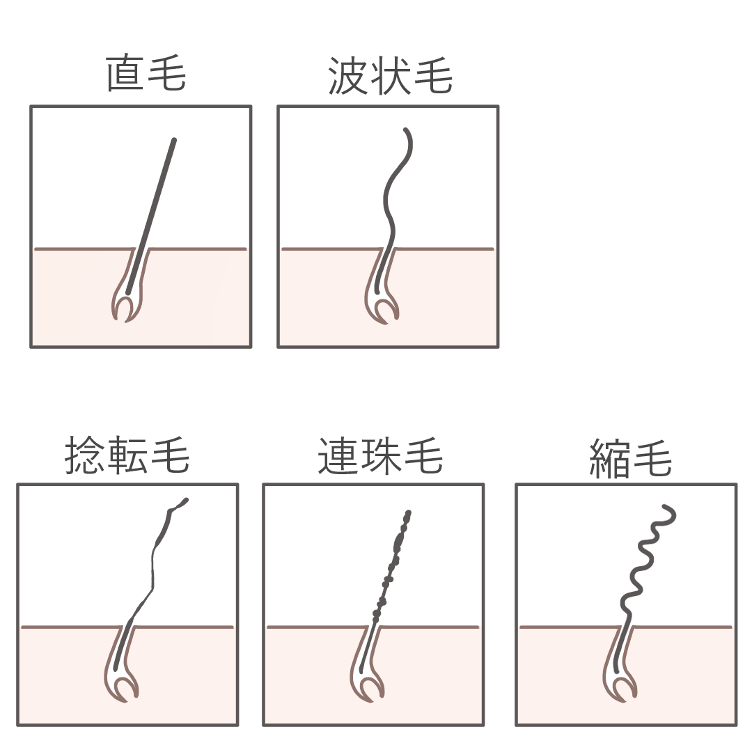 くせ毛の種類をまとめた図