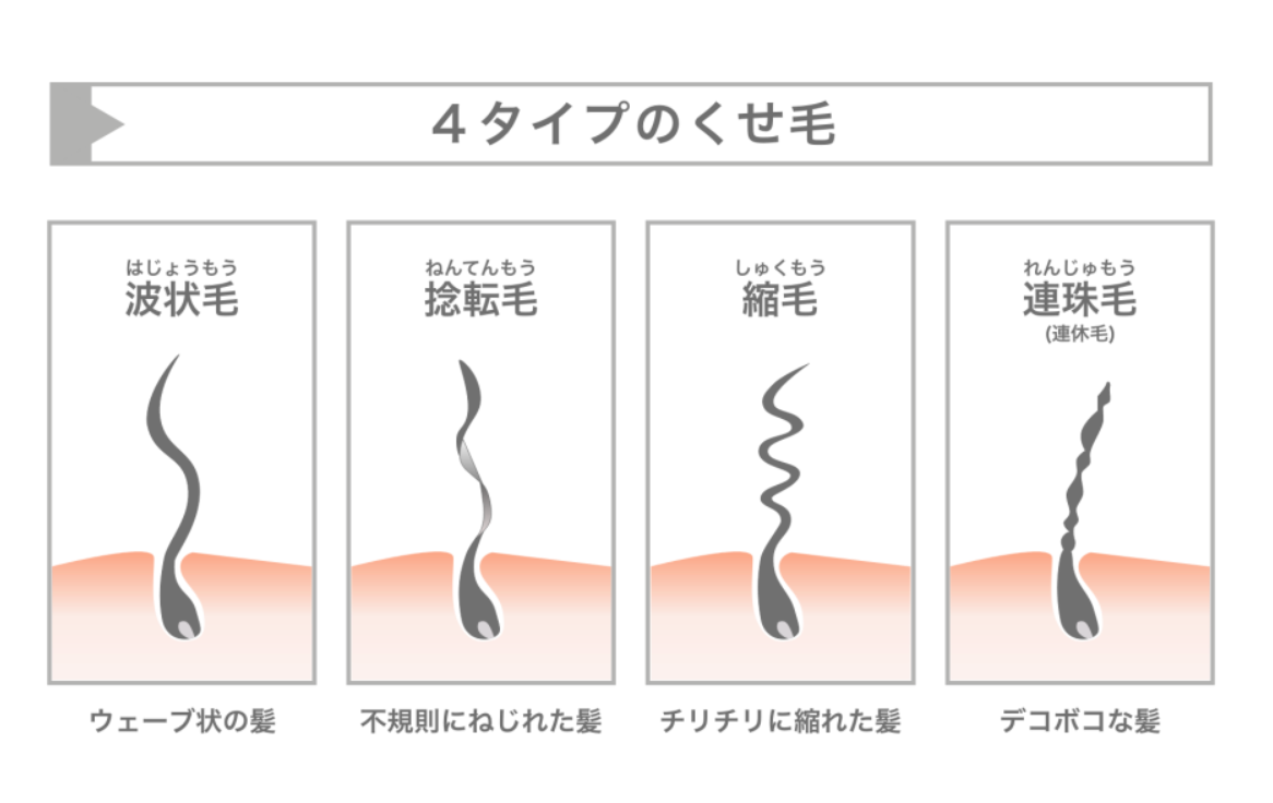 波状毛、捻転毛、縮毛、連珠毛（連休毛）の4つのくせ毛の種類