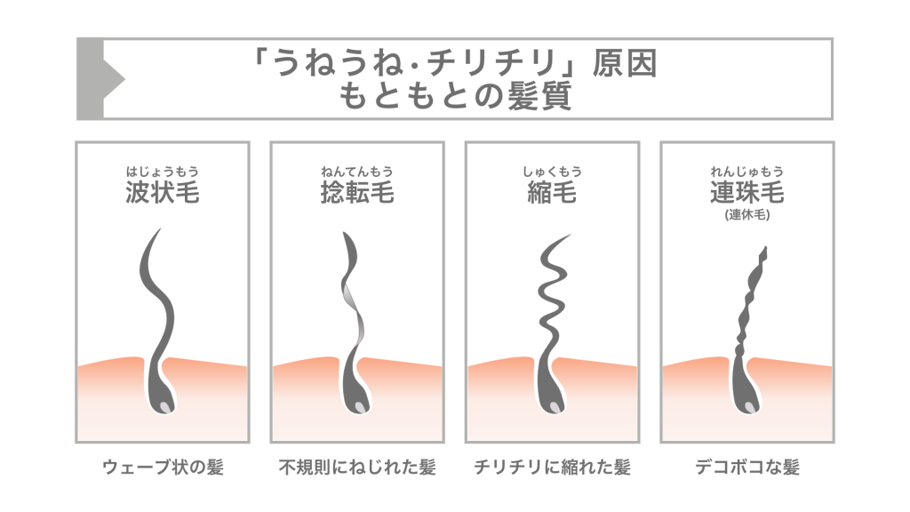 くせ毛の種類