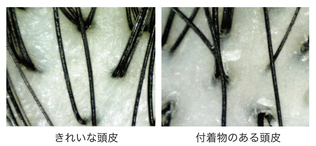 きれいな頭皮とワックスが付着した頭皮