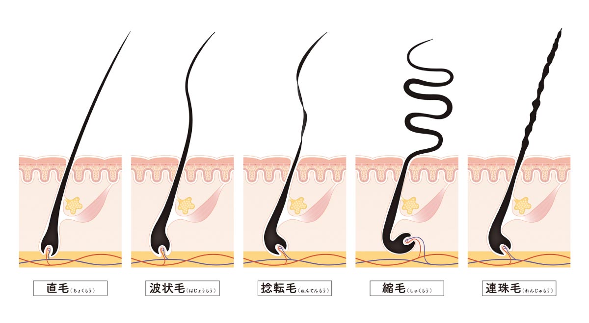 直毛とくせ毛の毛根の違い